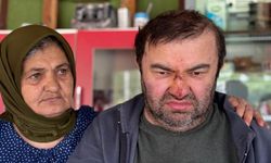 ENGELLİ VATANDAŞI DARP ETTİLER