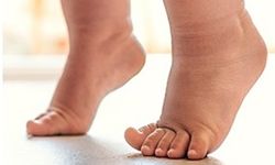 ÇOCUKLARDA BU YÜRÜYÜŞ ŞEKLİNE DİKKAT !