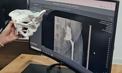 EREĞLİ'DE 60 YAŞINDAKİ KADINA 3D KALÇA PROTEZİ YERLEŞTİRİLDİ