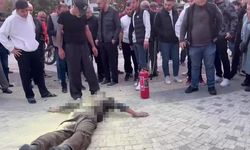 PSİKOLOJİK SORUNLARI OLAN ŞAHIS KENDİNİ YAKTI