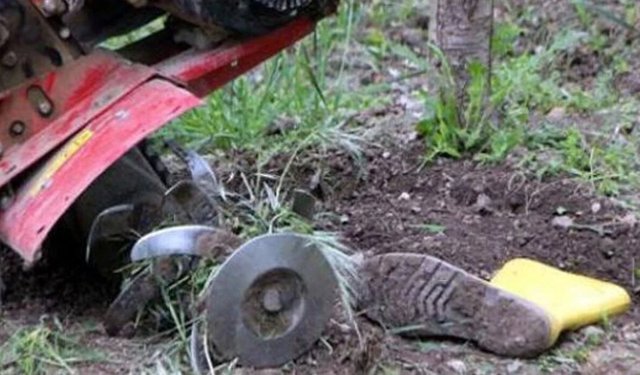 BACAKLARINI ÇAPA MAKİNESİNE KAPTIRAN ÇİGTÇİ AĞIR YARALANDI